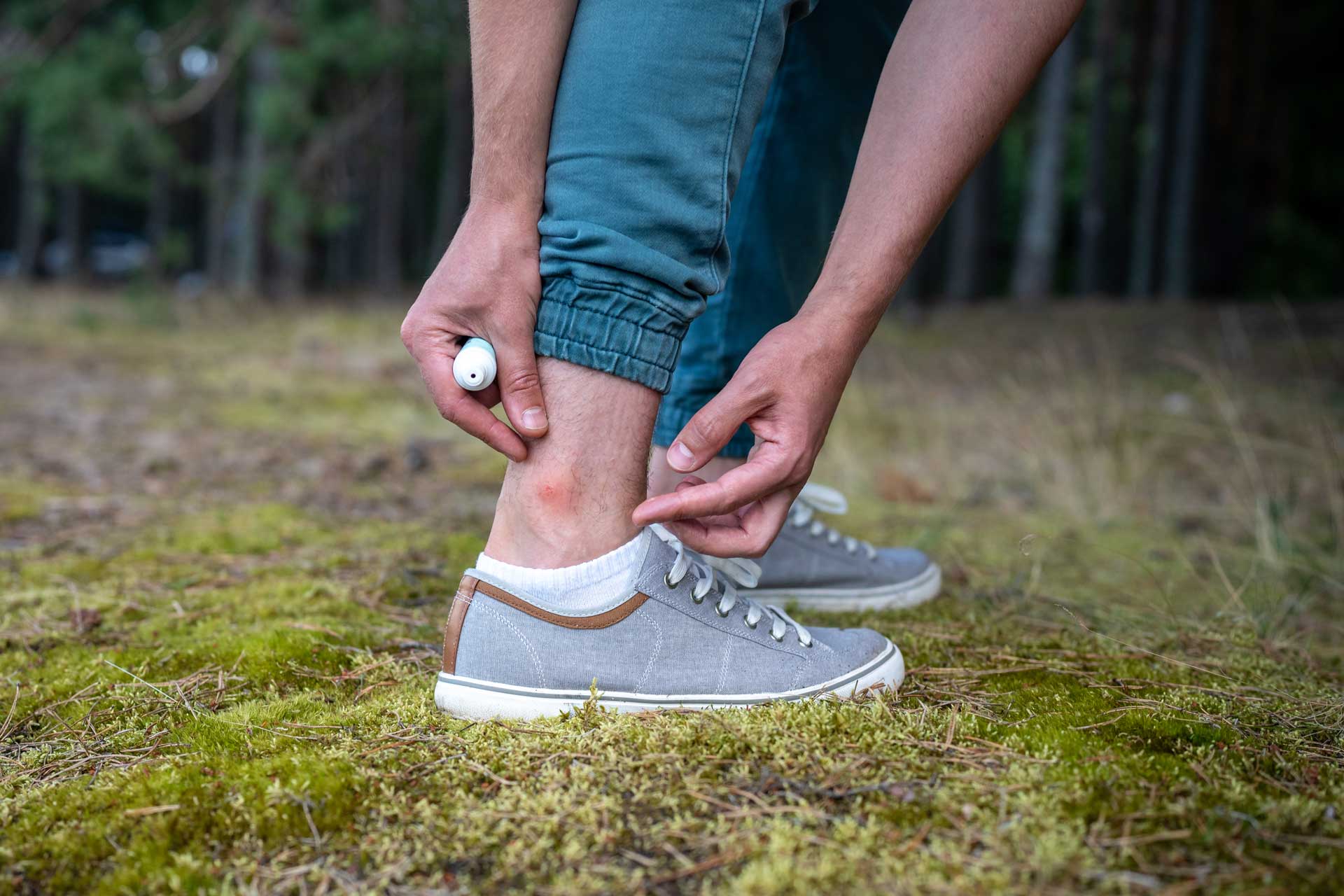 Outdoors Mosquito Bite In a Persons ancle 